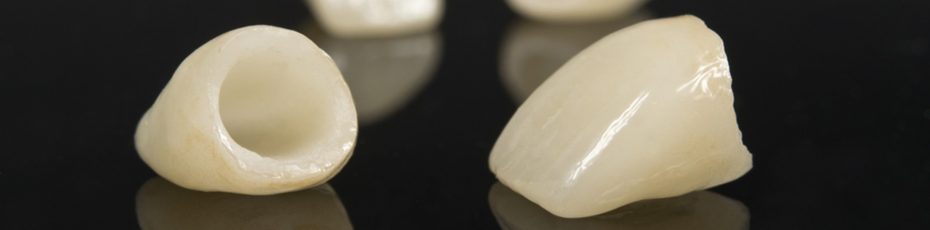 pros and cons of dental crowns