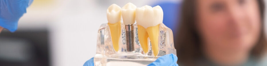 a dental implant is a painful process dispelling the myth