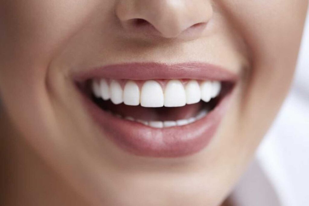 Alcohol, especially red wine and dark liquors, can stain your teeth.